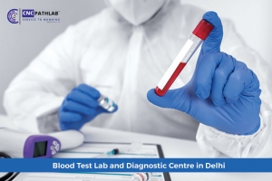 Blood Test Lab and Diagnostic Centre in Delhi