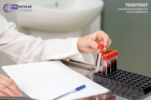 The Benefits of Taking a Blood Test in Delhi for Health Requirements
