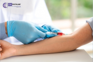How to Find Affordable Blood Test Options in Delhi Without Compromising Quality